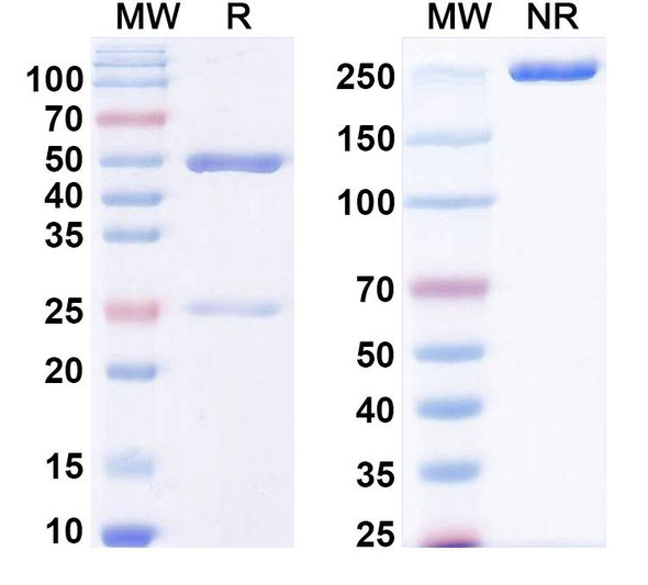 Anti-LPS/Lipid A Recombinant Monoclonal Antibody (SAA0580) - SDS-PAGE