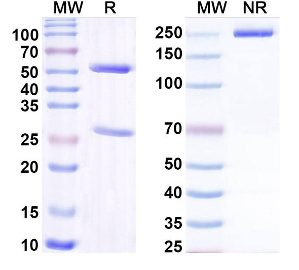 Anti-DERP1 Recombinant Monoclonal Antibody (SAA0622) - SDS-PAGE