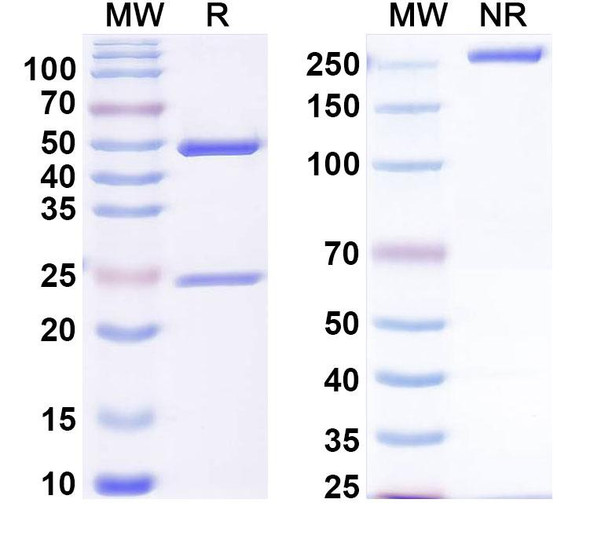 Anti-DERP2 Recombinant Monoclonal Antibody (SAA0624) - SDS-PAGE
