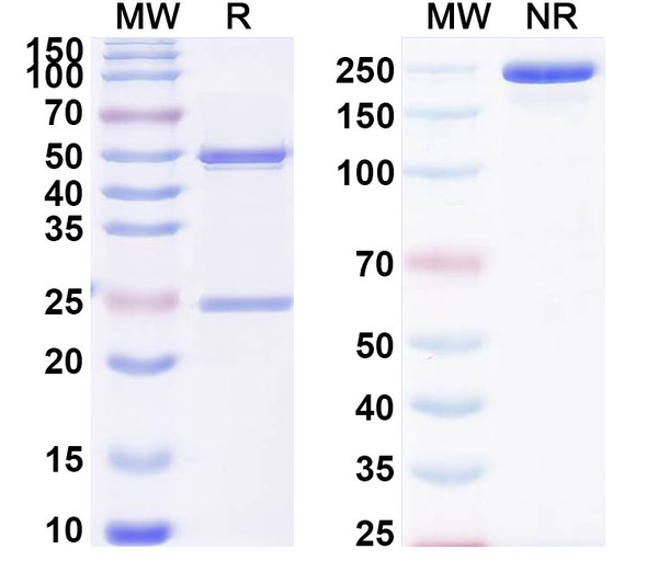 Anti-DERP2 Recombinant Monoclonal Antibody (SAA0628) - SDS-PAGE