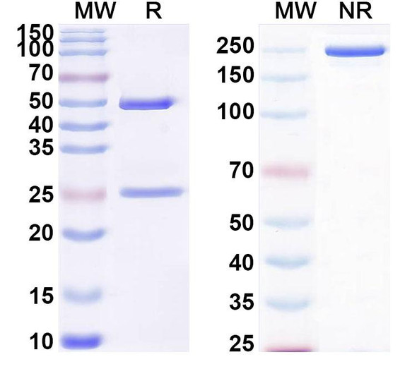 Anti-DERP2 Recombinant Monoclonal Antibody (SAA0633) - SDS-PAGE