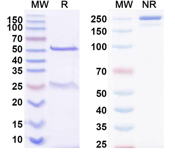 Anti-DERP2 Recombinant Monoclonal Antibody (SAA0637) - SDS-PAGE