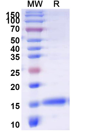 Anti-Mal f 1/Allergen Pit o 1 Recombinant Nanobody (SAA0638) - SDS-PAGE