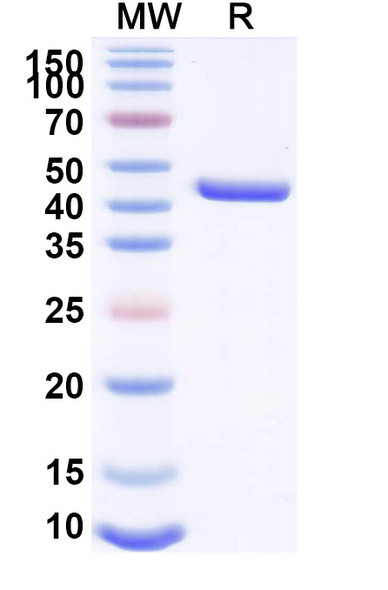 Anti-Mal f 1/Allergen Pit o 1 Recombinant Monoclonal Antibody (SAA0648) - SDS-PAGE