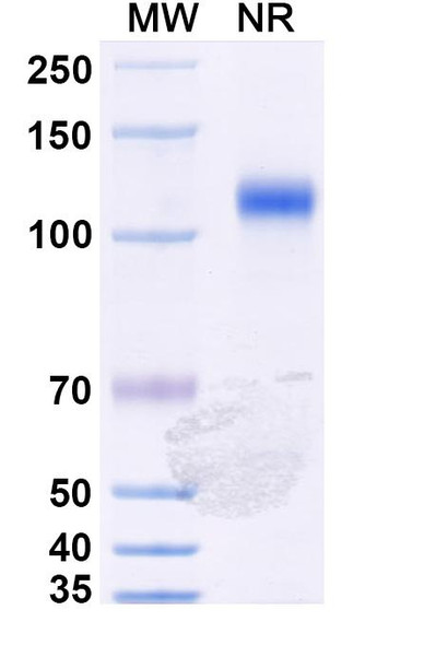 Anti-Mal f 1/Allergen Pit o 1 Recombinant Monoclonal Antibody (SAA0649) - SDS-PAGE