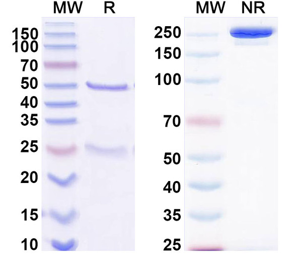 Anti-Bet v 1/Allergen Bet v I-A Recombinant Monoclonal Antibody (SAA0659) - SDS-PAGE