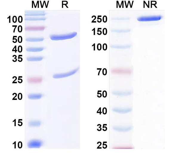 Anti-Bet v 1/Allergen Bet v I-A Recombinant Monoclonal Antibody (SAA0660) - SDS-PAGE