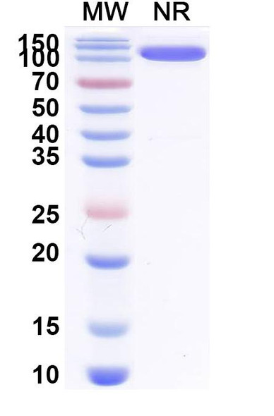Anti-Bet v 1/Allergen Bet v I-A Recombinant Monoclonal Antibody (SAA0668) - SDS-PAGE
