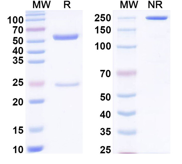 Anti-Bet v 1/Allergen Bet v I-A Recombinant Monoclonal Antibody (SAA0669) - SDS-PAGE