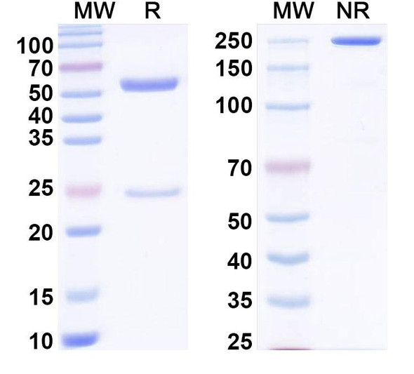 Anti-LolPII/Allergen Lol p2 Recombinant Monoclonal Antibody (SAA0671) - SDS-PAGE