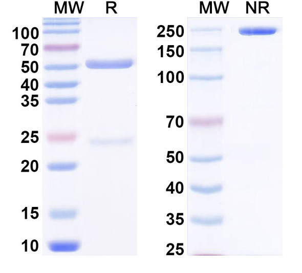 Anti-PHLPI/Allergen Phl p I Recombinant Monoclonal Antibody (SAA0679) - SDS-PAGE