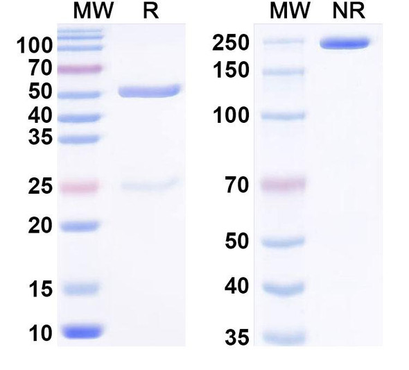 Anti-PHLPI/Allergen Phl p I Recombinant Monoclonal Antibody (SAA0682) - SDS-PAGE