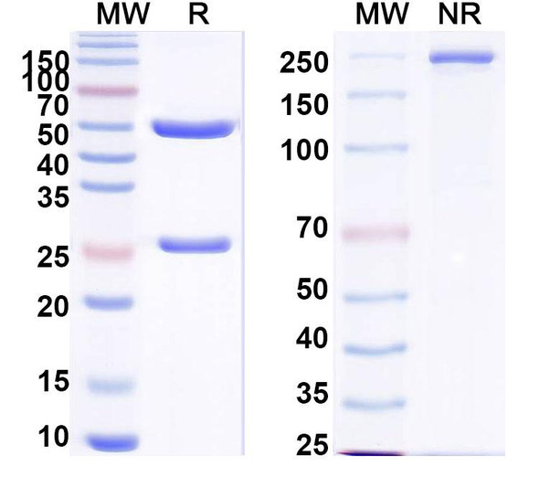 Anti-PHLPVa/Allergen Phl p Va Recombinant Monoclonal Antibody (SAA0689) - SDS-PAGE