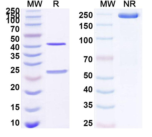 Anti-PHLPVa/Allergen Phl p Va Recombinant Monoclonal Antibody (SAA0692) - SDS-PAGE