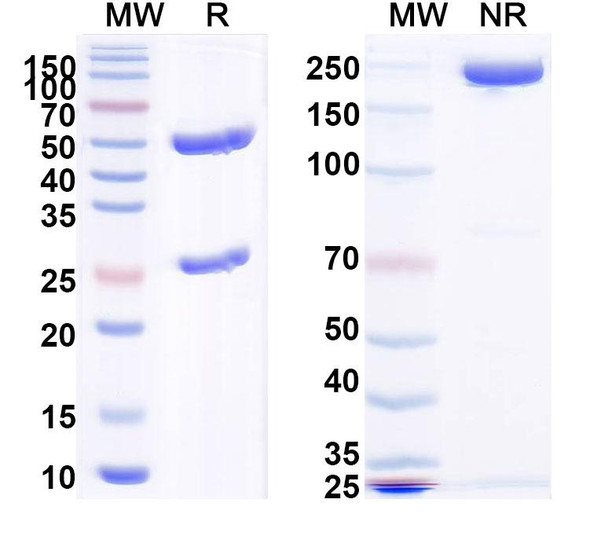 Anti-PHLPVa/Allergen Phl p Va Recombinant Monoclonal Antibody (SAA0695) - SDS-PAGE