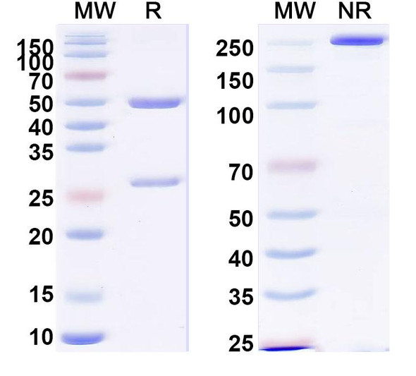 Anti-PHLPVa/Allergen Phl p Va Recombinant Monoclonal Antibody (SAA0701) - SDS-PAGE
