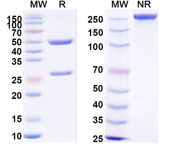 Anti-PHLPVa/Allergen Phl p Va Recombinant Monoclonal Antibody (SAA0704) - SDS-PAGE