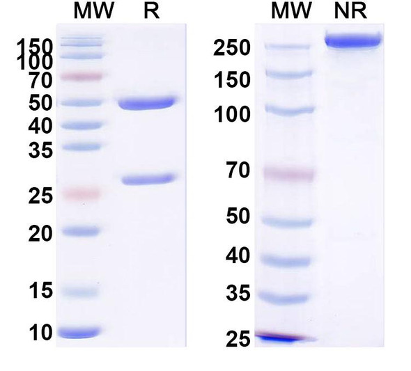 Anti-PHLPVa/Allergen Phl p Va Recombinant Monoclonal Antibody (SAA0704) - SDS-PAGE