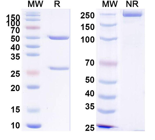 Anti-PHLPV/Allergen Phl p V Recombinant Monoclonal Antibody (SAA0709) - SDS-PAGE