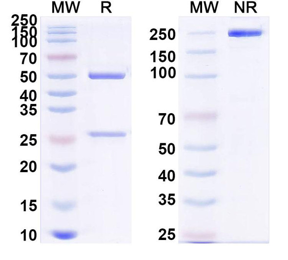 Anti-PHLPV/Allergen Phl p V Recombinant Monoclonal Antibody (SAA0723) - SDS-PAGE