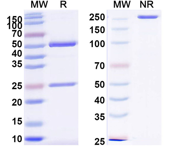 Anti-PHLPV/Allergen Phl p V Recombinant Monoclonal Antibody (SAA0726) - SDS-PAGE