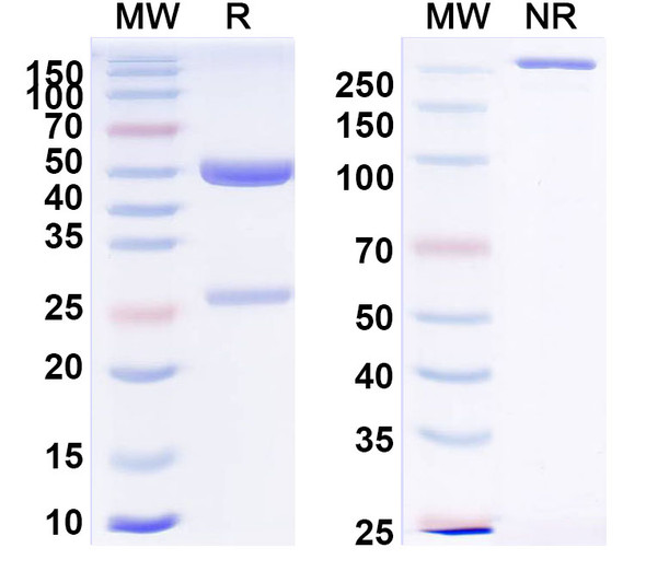 Anti-PHLPV/Allergen Phl p V Recombinant Monoclonal Antibody (SAA0727) - SDS-PAGE