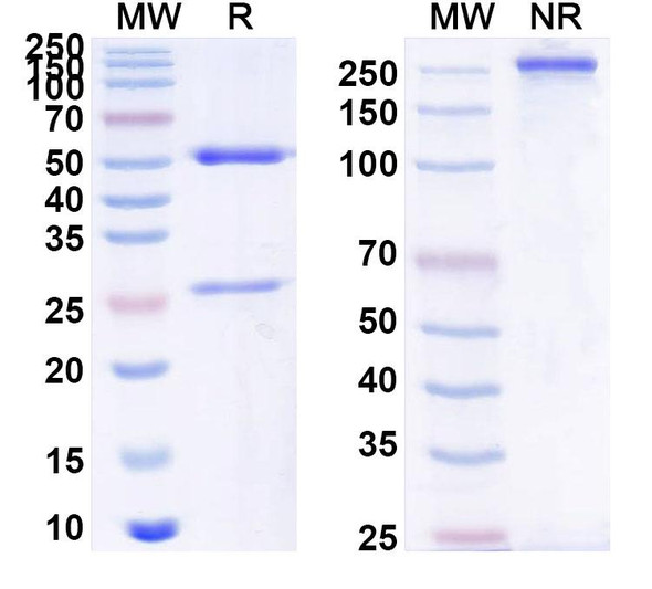 Anti-PHLPVI Recombinant Monoclonal Antibody (SAA0737) - SDS-PAGE