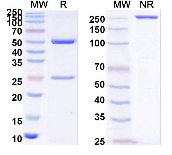 Anti-PHLPVI Recombinant Monoclonal Antibody (SAA0740) - SDS-PAGE