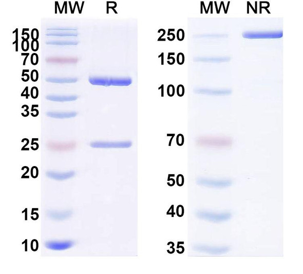 Anti-Allergen Pis v 2/11S globulin Recombinant Monoclonal Antibody (SAA0756) - SDS-PAGE