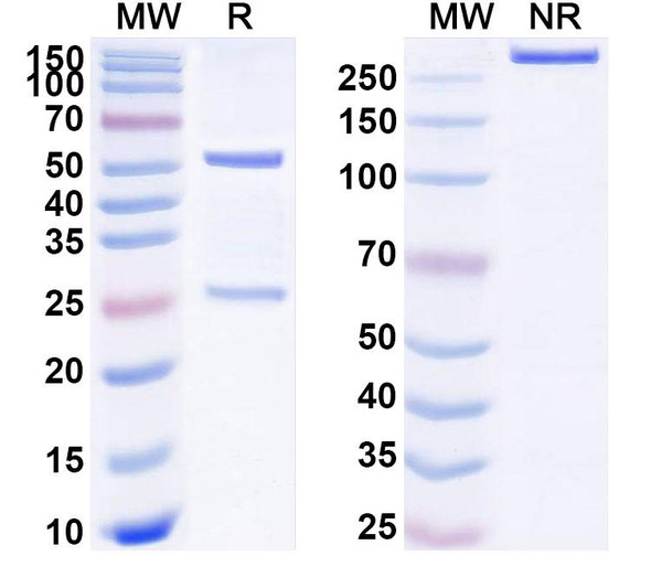 Anti-Human GPRC5D Recombinant Monoclonal Antibody (SAA0764) - SDS-PAGE