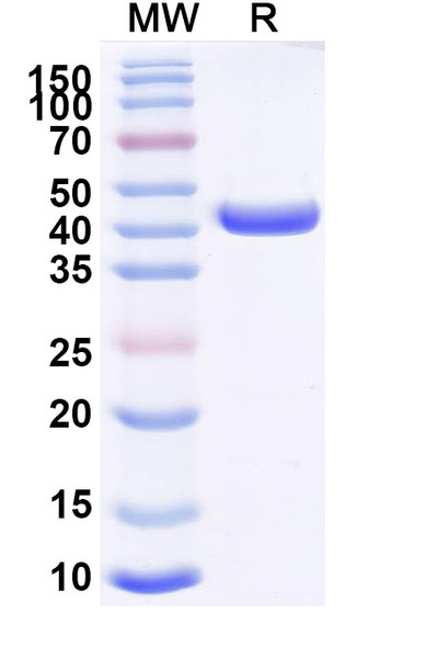 Anti-MPXV A29L Recombinant Monoclonal Antibody (P1F2) - SDS-PAGE