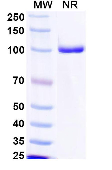 Anti-MPXV A29L Recombinant Monoclonal Antibody (P2G3) - SDS-PAGE