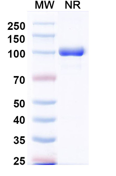 Anti-MPXV A29L Recombinant Monoclonal Antibody (P2H9) - SDS-PAGE