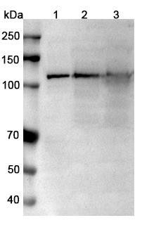 Anti-Human TRPM4/LTRPC4 Recombinant Monoclonal Antibody (SAA0760) - WB