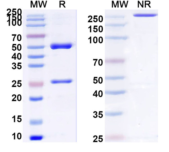 Anti-Human CFP/Properdin Recombinant Monoclonal Antibody (SAA0781) - SDS-PAGE