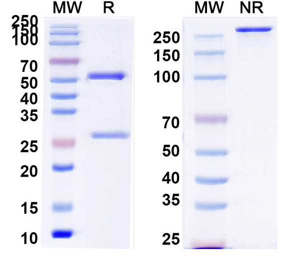 Anti-MPTS Recombinant Monoclonal Antibody (SAA0788) - SDS-PAGE