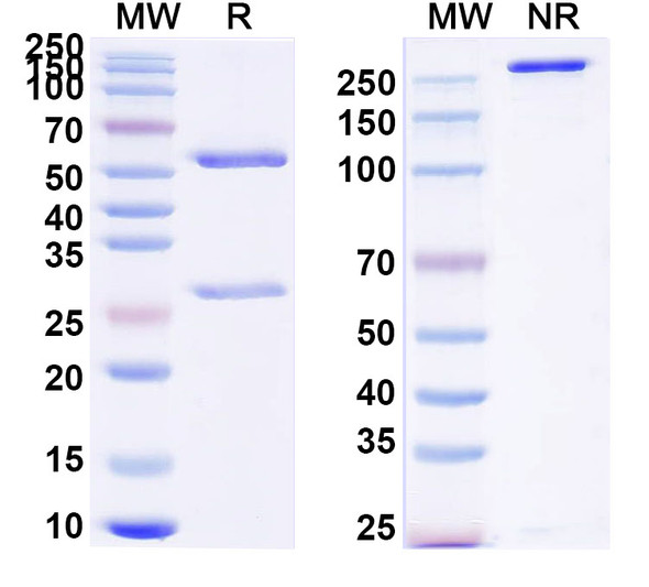 Anti-Human LRP5/6 Recombinant Monoclonal Antibody (SAA0791) - SDS-PAGE