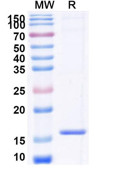 Anti-Human CXCR7/ACKR3 Recombinant Nanobody (SAA0795) - SDS-PAGE