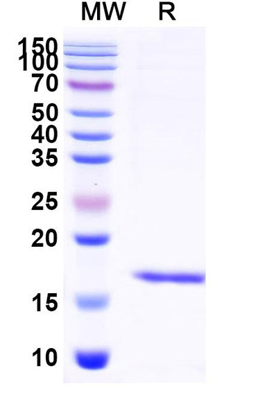 Anti-Human Albumin/HSA Recombinant Nanobody (SAA0807) - SDS-PAGE
