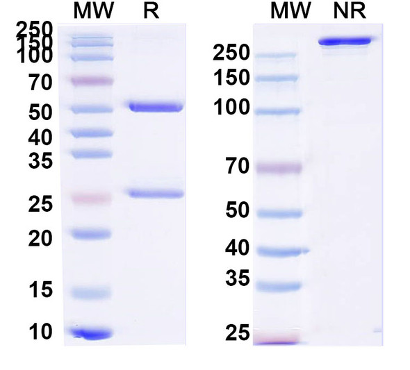 Anti-Human CX43/GJA1 Recombinant Monoclonal Antibody (SAA0823) - SDS-PAGE