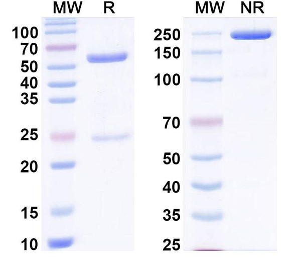Anti-Human C5/Complement C5 Recombinant Monoclonal Antibody (SAA0831) - SDS-PAGE