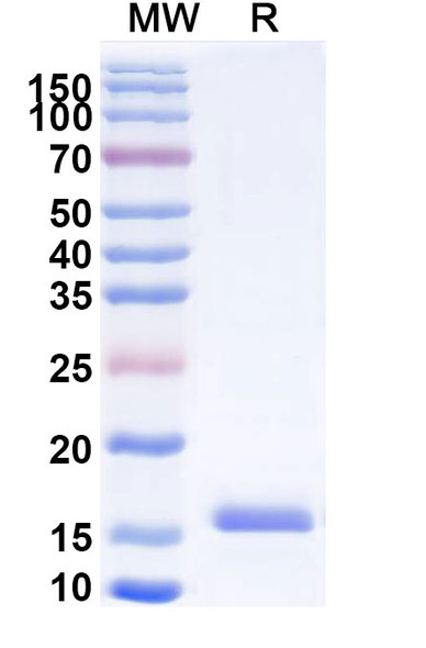 Anti-Human CD66e/CEA/CEACAM5 Recombinant Nanobody (SAA0838) - SDS-PAGE