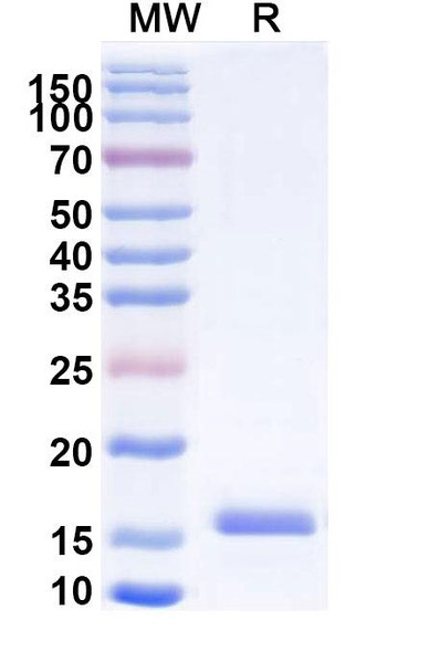 Anti-Human CD66e/CEA/CEACAM5 Recombinant Nanobody (SAA0838) - SDS-PAGE