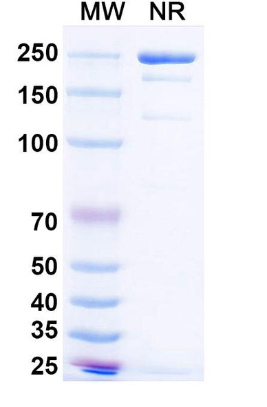 Anti-HMPV F/Fusion Protein Recombinant Monoclonal Antibody (SAA0840) - SDS-PAGE