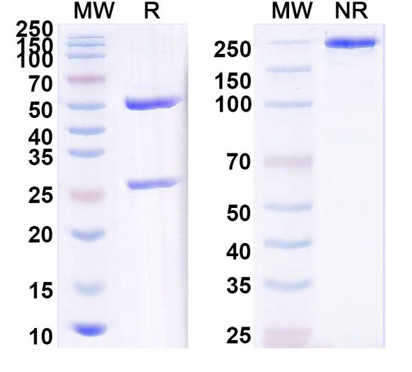 Anti-Clostridium tetani tetX/Tetanus toxin Recombinant Monoclonal Antibody (SAA0854) - SDS-PAGE