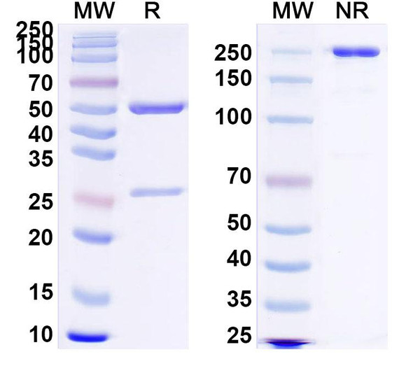 Anti-Clostridium tetani tetX/Tetanus toxin Recombinant Monoclonal Antibody (SAA0856) - SDS-PAGE