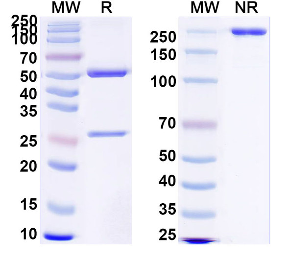 Anti-Clostridium tetani tetX/Tetanus toxin Recombinant Monoclonal Antibody (SAA0860) - SDS-PAGE
