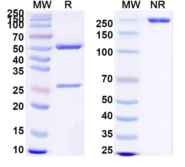 Anti-Clostridium tetani tetX/Tetanus toxin Recombinant Monoclonal Antibody (SAA0860) - SDS-PAGE