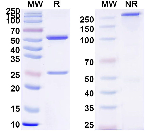 Anti-Clostridium tetani tetX/Tetanus toxin Recombinant Monoclonal Antibody (SAA0861) - SDS-PAGE