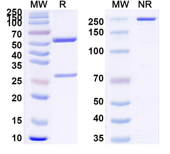 Anti-Clostridium tetani tetX/Tetanus toxin Recombinant Monoclonal Antibody (SAA0865) - SDS-PAGE